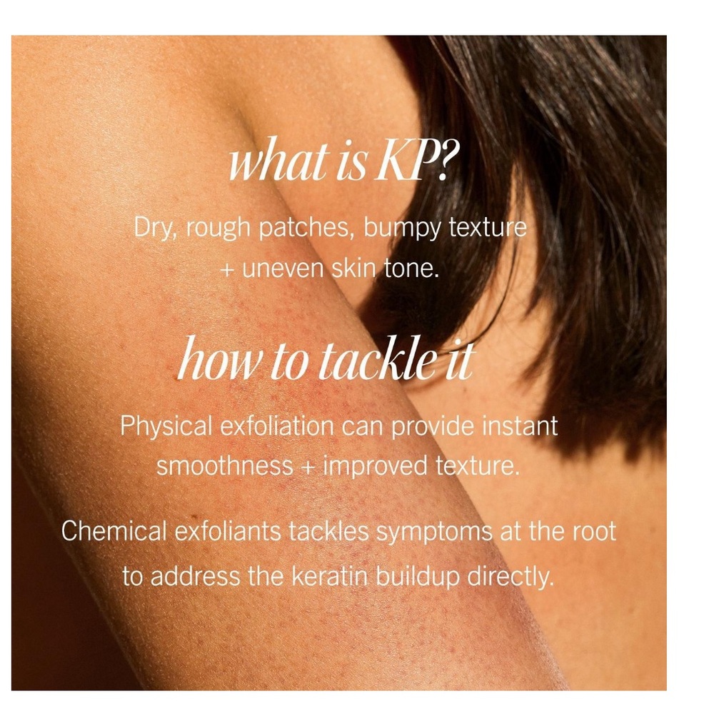 First Aid Beauty - KP Bump Eraser Body Scrub with 10% AHA - Picture 5 of 7